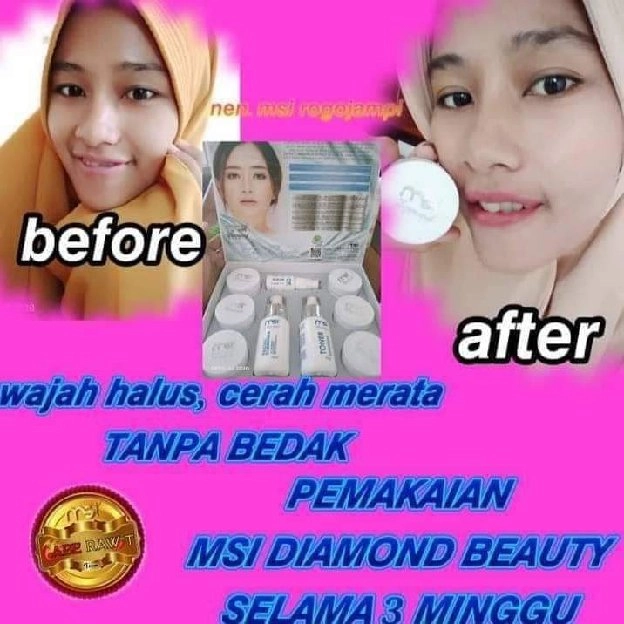 MSI DIAMOND BEAUTY SKINCARE 