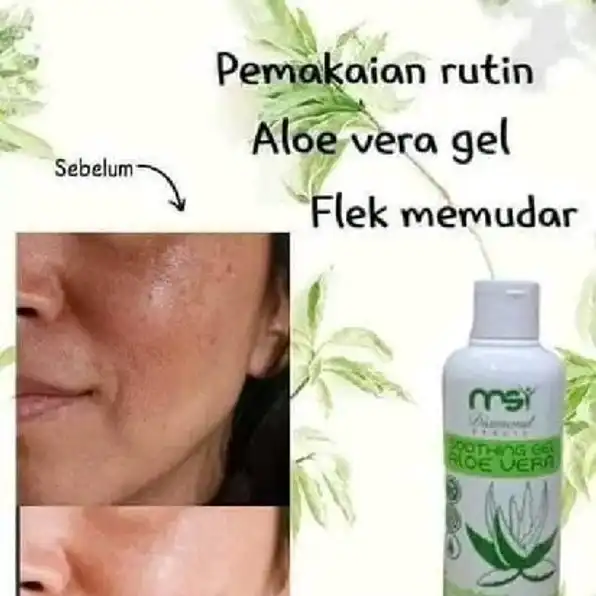 ALOE VERA MSI