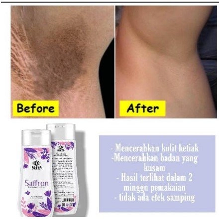 Toner Badan Whitening Aleya Penghilang Bekas Luka Toner Pemutih Kulit Saffron Toner Glowing Bpom I I