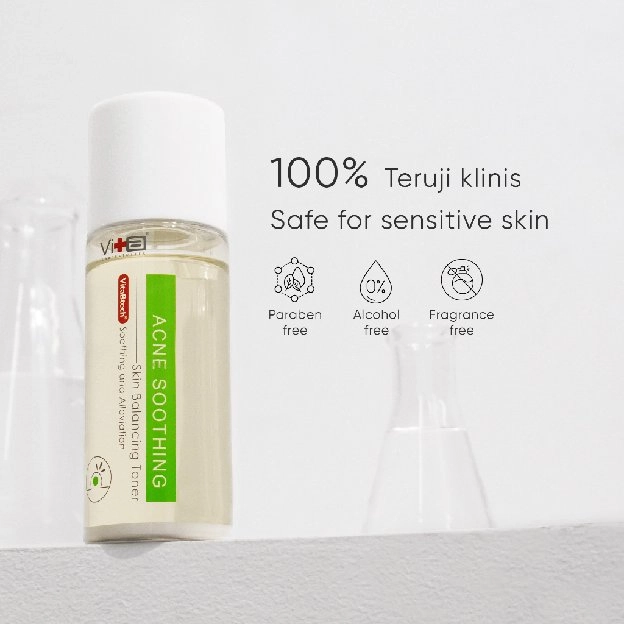 Swissvita Acne Skin Balancing Toner 120 ml | Angkat Komedo | Redakan Jerawat | Samarkan Pori Besar |