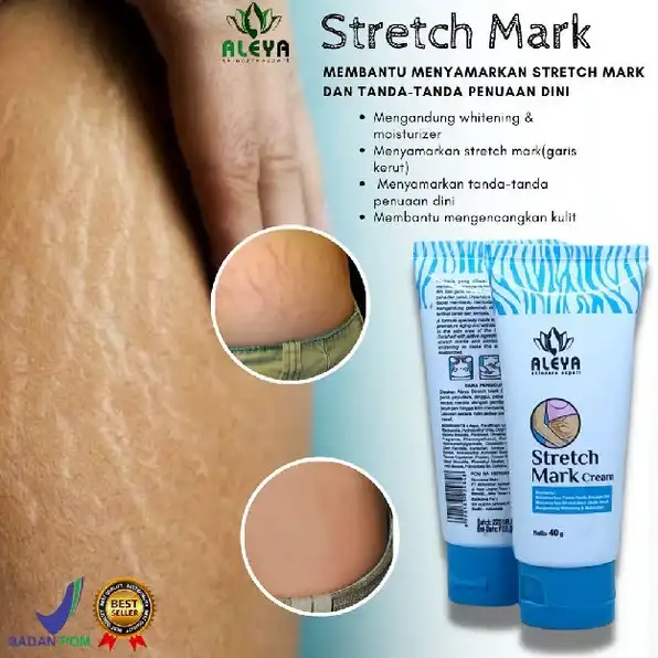 Cream Penghilang Bekas Luka Bekas Strech Mark