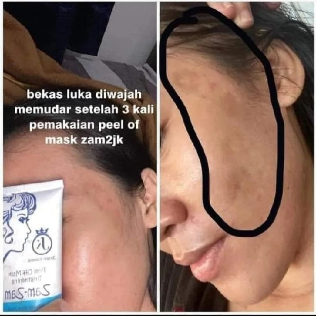 masker zamzamjk