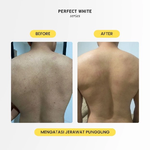 Body Serum Whitening & Moisturizing | Serum Pemutih Badan