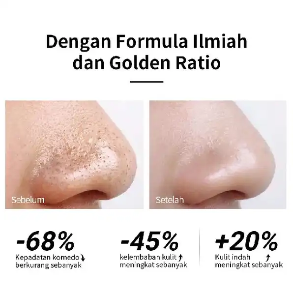 [BPOM] LANBENA Blackhead Remover Mask Masker wajah masker komedo - Pembersih Komedo Perawatan jerawa