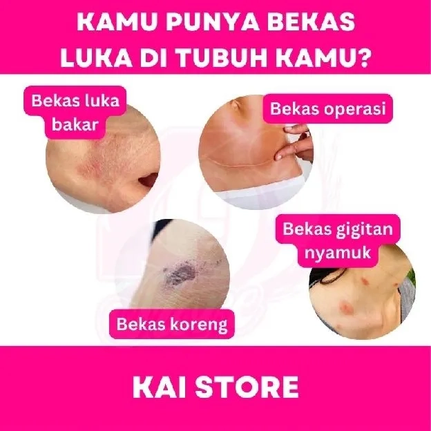 Obat Cream Krim Salep Penghilang Mengobati Luka Kulit Lama Cacar Bekas Jerawat Flek Hitam Keloid