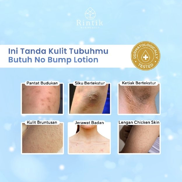 No Bump Lotion / Lotion Tubuh Kulit Bruntusan, Jerawat Punggung & Chicken skin 100ml