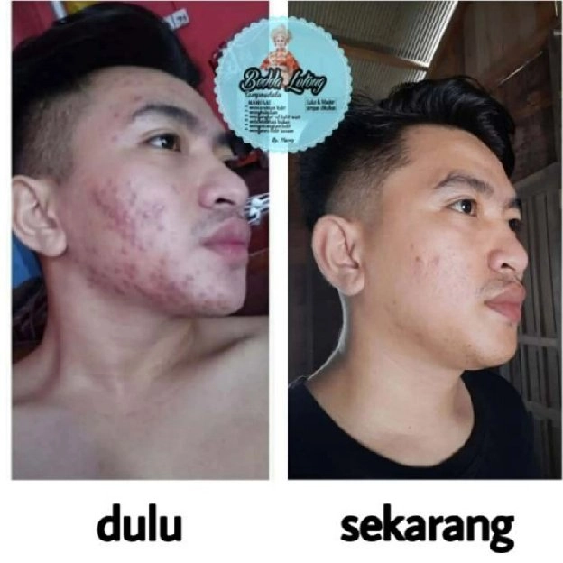 Lulur Henny bedda lotong viral BPOM Original Promo pemutih badan bubuk basah agen resmi