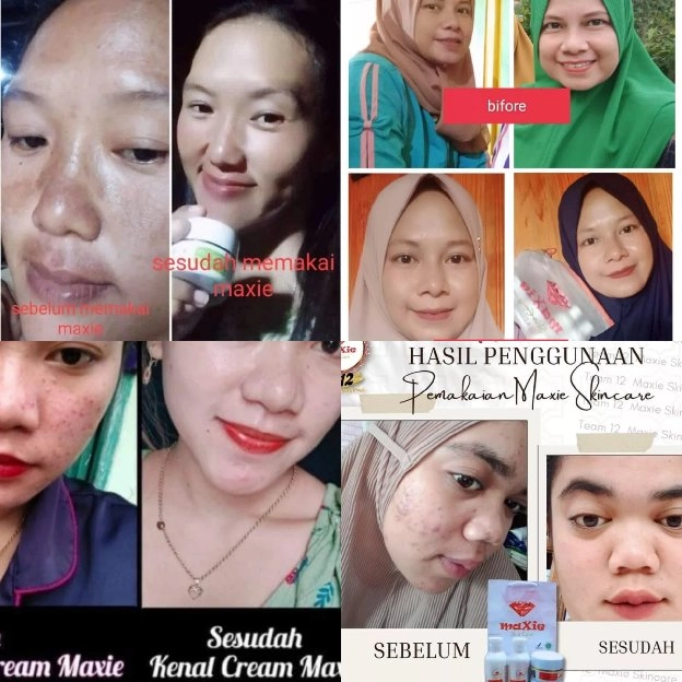 Maxie Skincare terlarisss