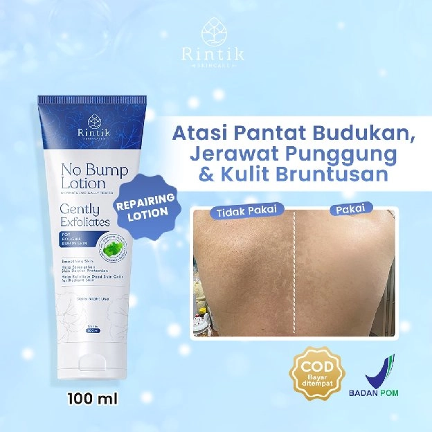 No Bump Lotion / Lotion Tubuh Kulit Bruntusan, Jerawat Punggung & Chicken skin 100ml