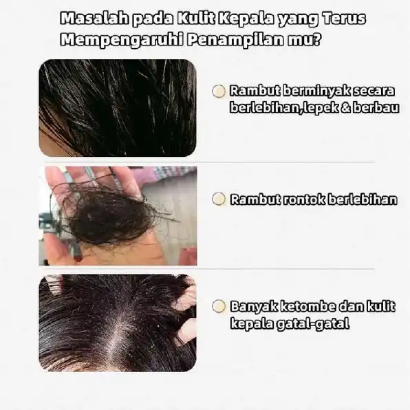 Auror Remimpi Shampo Penumbuh Rambut Cepat Anti Hair Fal Shampo Oil Control Anti Dandruff Membantu P