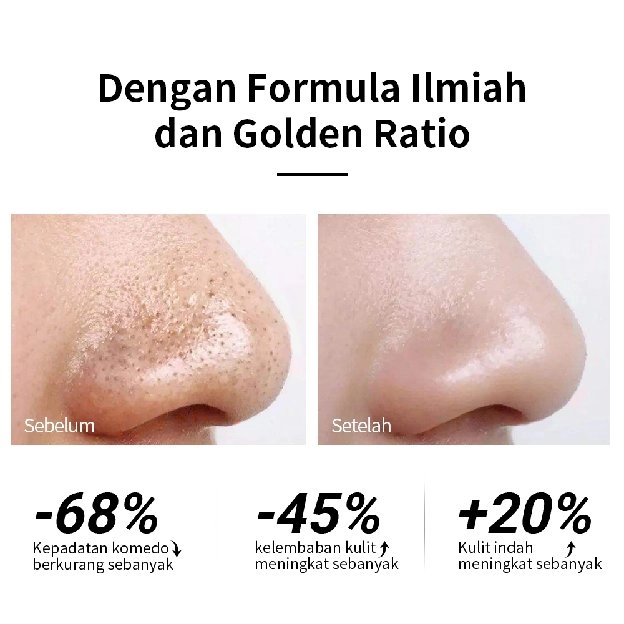 [BPOM] Lanbena Masker Komedo Wajah Komedo-Pengangkat /Pembersih Komedo /Masker Hidung /Pencabut kome