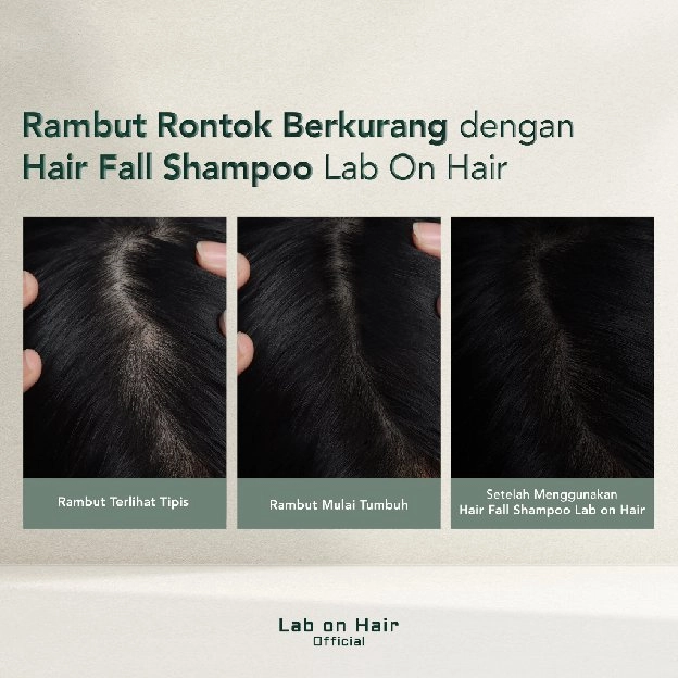 Sampo Perawatan Rambut Anti Rontok Anti Hair Fall Shampo with Redensyl + eMortal Pep + Ginger + Gins