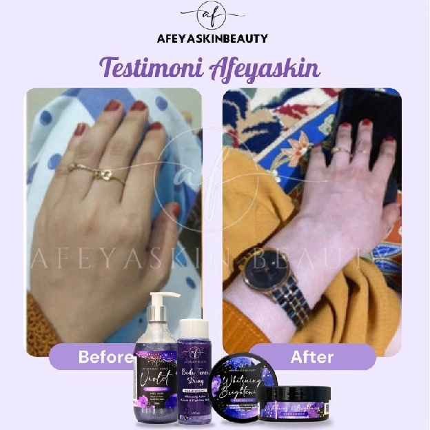 PAKET BUNDLING HEMAT AFEYASKIN BEAUTY / PAKET HEMAT BODYCARE AFEYASKIN / PAKET MURAH AFEYASKIN