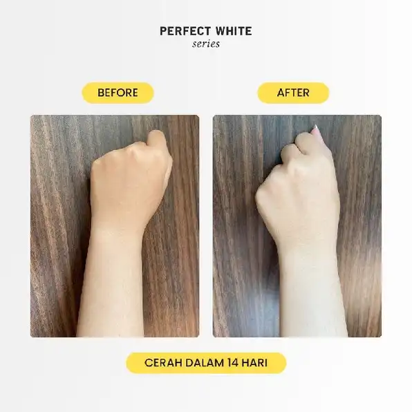 PERFECT WHITE AHA Body Serum Whitening & Moisturizing