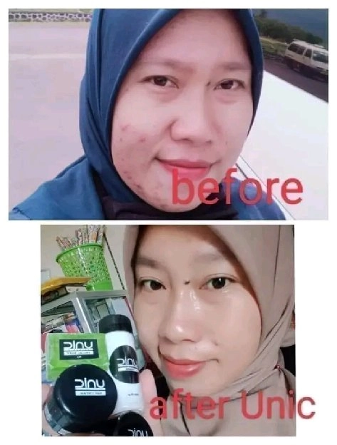 UNIC skincare