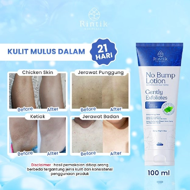 No Bump Lotion / Lotion Tubuh Kulit Bruntusan, Jerawat Punggung & Chicken skin 100ml