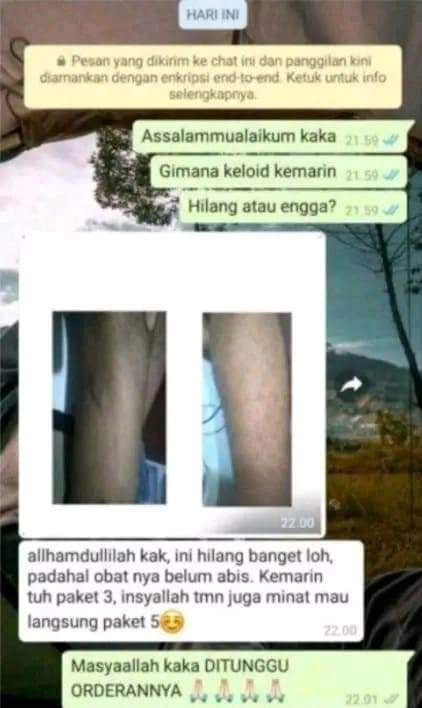 AYO LANGSUNG ORDER!! PENGHILANG BEKAS LUKA, KORENG, ESKIM, KELOID, GATAL GATAL, PANU DLL (BISA COD)