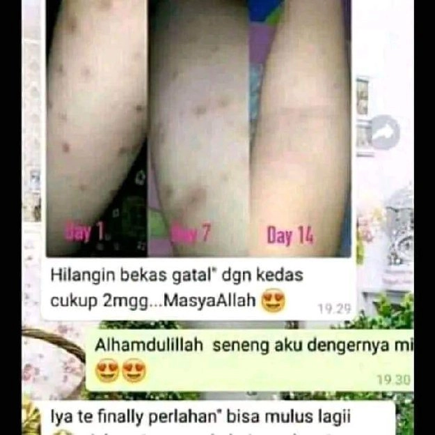 AYO LANGSUNG ORDER!! PENGHILANG BEKAS LUKA, KORENG, ESKIM, KELOID, GATAL GATAL, PANU DLL (BISA COD)