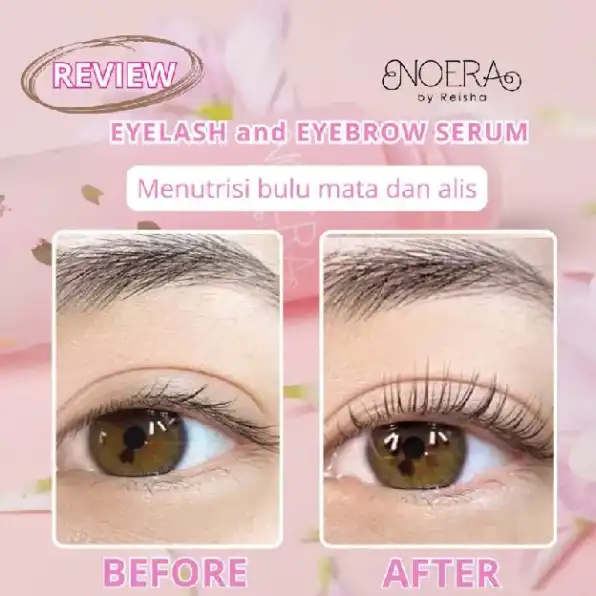 Noera Eyelash & Eyebrow Serum | Serum Bulu Mata dan Alis | Serum Pemanjang Bulu Mata