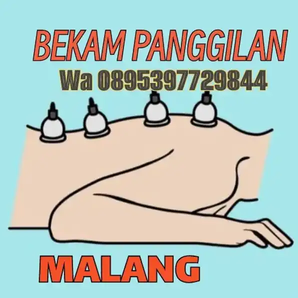 Bekam Sunahh Malang wa 0895397729844