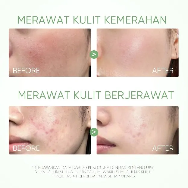 SKINTIFIC - Clay Mask Stick Collection Kit Masker Wajah -Mugwort Acne Clay Stick 40g & Alaska Volcan