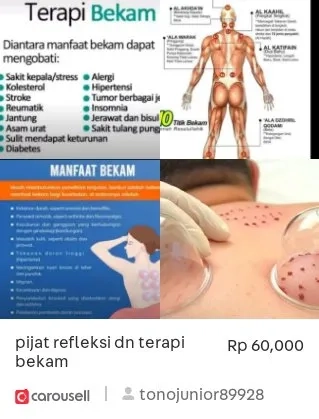 pijat refleksi dn terapi bekam