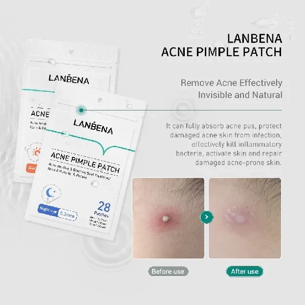 [BPOM] Lanbena Acne Pimple Patch Obat Jerawat Masker Jerawat Penghilang Jerawat Stickers Invisble St