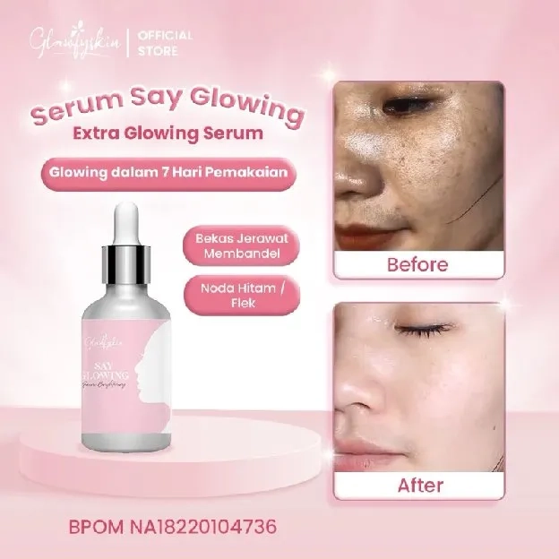 Serum Jerawat By Glawfyskin BPOM