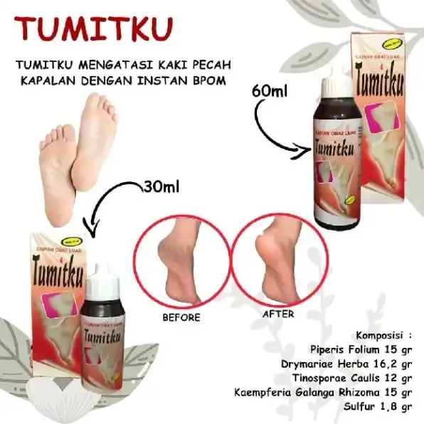 TUMITKU Obat Kaki Pecah 100% Original BPOM Solusi Kaki Pecah-pecah Kapalan Kering Ampuh