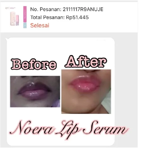 Serum Bibir Pemerah Pencerah Bibir Pink Alami | Serum Bibir Untuk Bibir Hitam | Vitamin Bibir