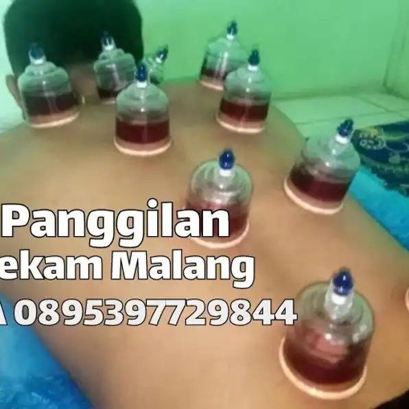 bekam malang panggilan Wa 0895397729844