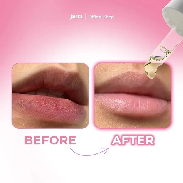 Advanced Natural Lip Serum with Vitamin C Extra Mencerahkan 20ml - Jiera Official Shop | Pemerah dan