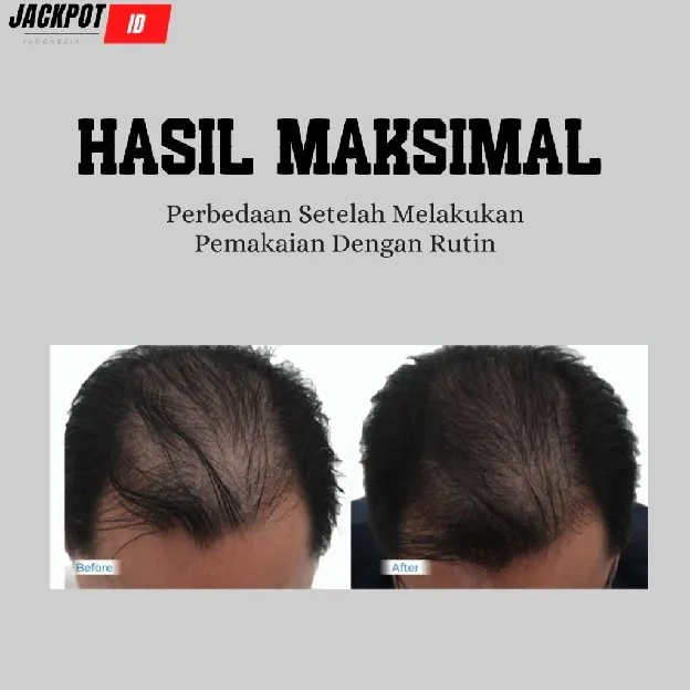 MINYAK KEMIRI BAKAR ( ORIGINAL ASLI ORGANIC ) - Penumbuh dan Penghitam Rambut Jenggot Kumis Jabang A