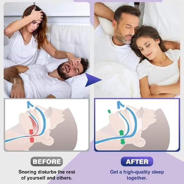 Alat Anti Ngorok Dengkur Magnet - Snore Stopper - Nose Breathing Stop Snoring Magnetic