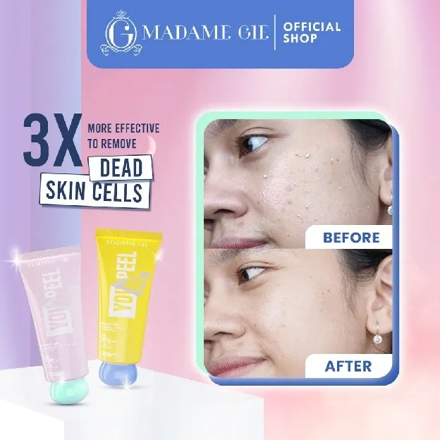 MADAME GIE YOU PEEL ME - 3 MORE EFFECTIVE PEELING GEL DEAD SKIN BPOM