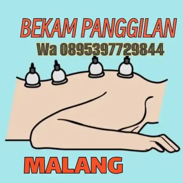 Jasa bekam panggilan Malang wa 0895397729844