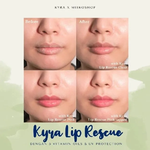 KYRA LIP RESCUE PINK with colour changing clear, Lipserum , Lipbalm UV Protection - Mencerahkan Bibi