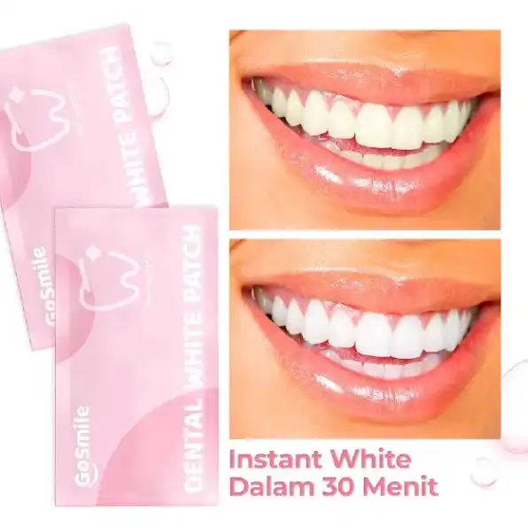 Go Smile Dental White Patch - Untuk Memutihkan Gigi seperti Bleaching dengan Glycerin Menthol dan PV