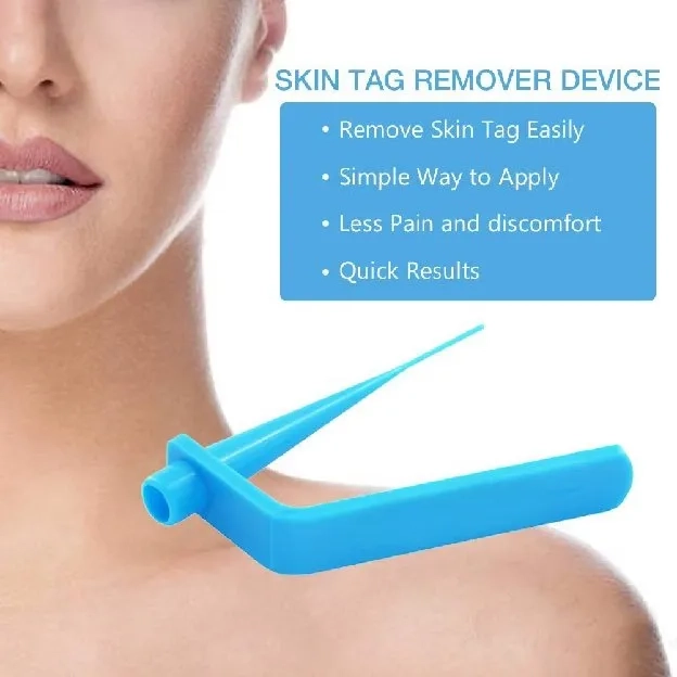 Skin Tag Removal Kit Skin Tag Remover Wart Remover Obat Kutil Penghilang Wart Removal Kit High Quali