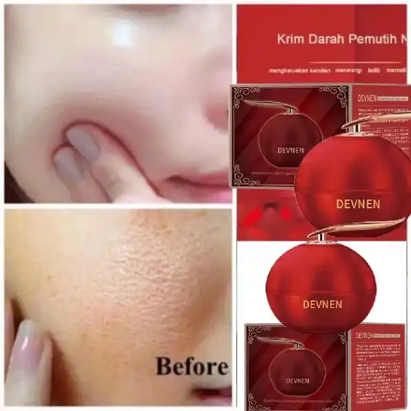 Krim Pemutih Dragon Blood Cream | krim pemutih Kuat Tahan Air Dan Pelembab Memutihkan Anti Aging