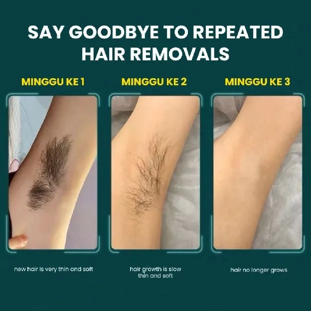 IPL laser Hair Removal Perontok Bulu Permanent Alat Penghilang bulu TANPA SAKIT 999999 FLASH