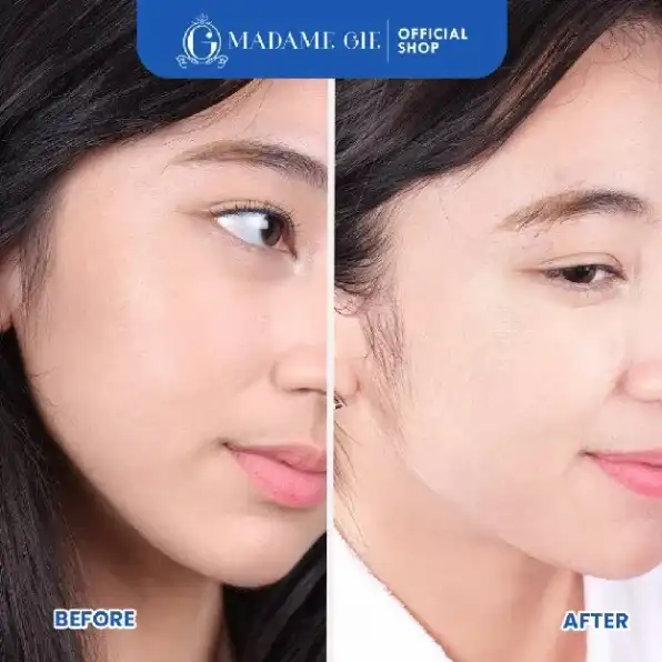 Madame Gie Necessity Sheet Mask - Masker Perawatan Wajah