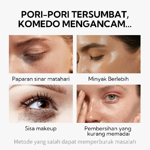 [BPOM] Lanbena Masker Komedo Wajah Komedo-Pengangkat /Pembersih Komedo/Masker Hidung/Pencabut komedo