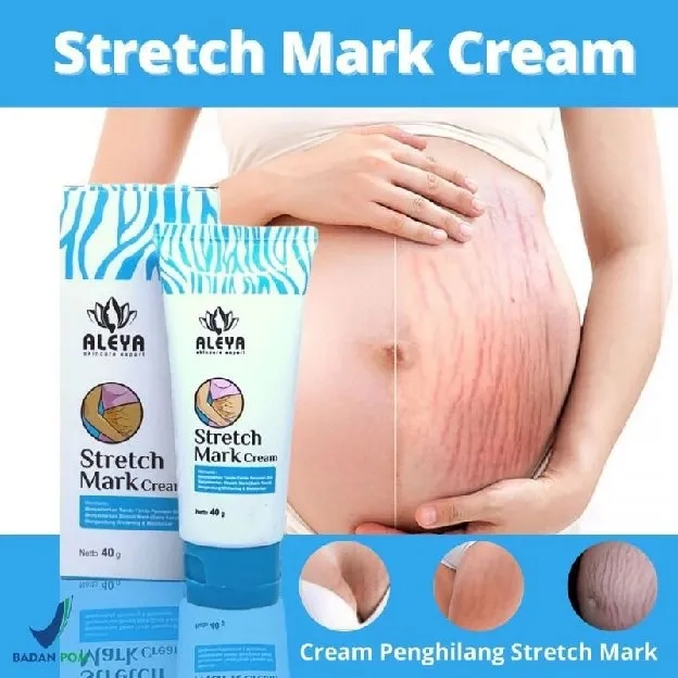 Aleya Strech Mark Cream | Cream Penghilang Bekas Luka Bekas Strech Mark