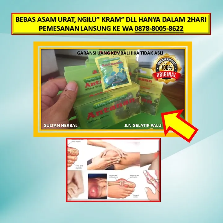 0878-8005-8622 Obat Alami Menurunkan Kadar Kolesterol Di Kota Palu