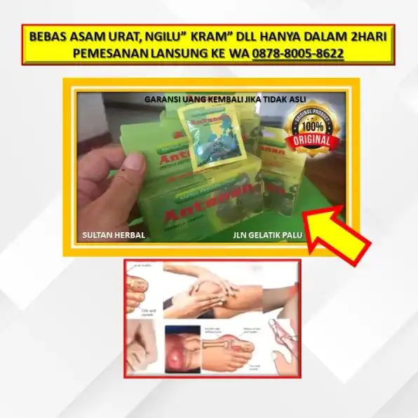 0878-8005-8622 Obat Alami Kolesterol Buat Ibu Hamil Di Kota Palu