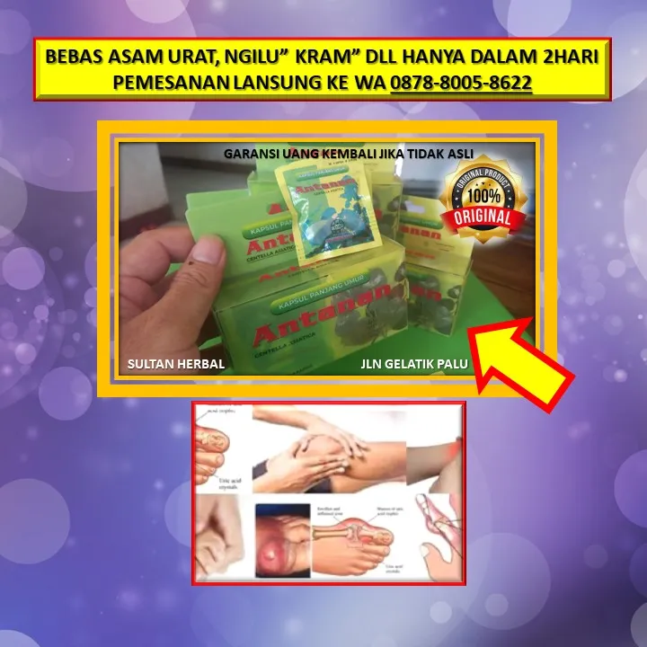 0878-8005-8622 Obat Alami Menurunkan Kolesterol Dan Darah Tinggi Di Kota Palu