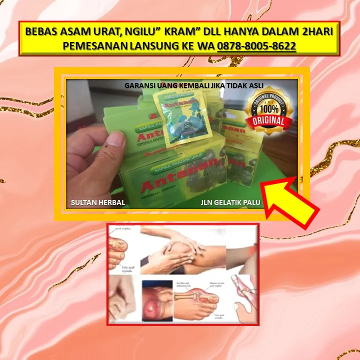 WA: 0878-8005-8622 Obat Kolesterol Buat Busui Di Kota Palu