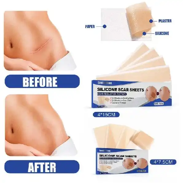 Silicone Scar Sheet lester silikon penghilang keloid bekas luka