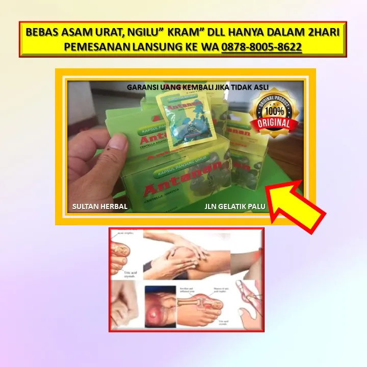 WA: 0878-8005-8622 Obat Kolesterol Kaki Bengkak Di Kota Palu